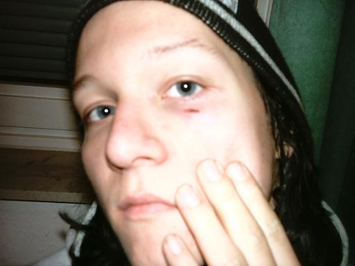 Bloody M3nt0R - Patrick Plue