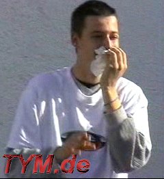 DJs blutige Lippe